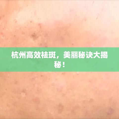 杭州高效祛斑，美麗秘訣大揭秘！