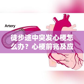 徒步途中突發(fā)心梗怎么辦？心梗前兆及應對措施科普！