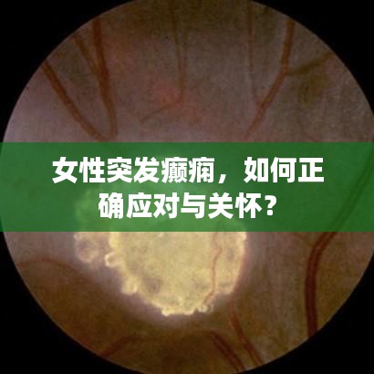 女性突發(fā)癲癇，如何正確應(yīng)對與關(guān)懷？