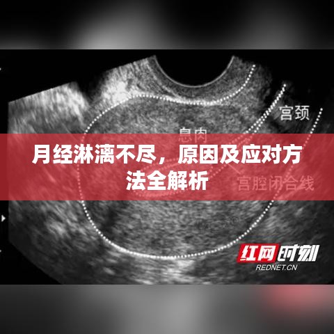 月經(jīng)淋漓不盡，原因及應(yīng)對方法全解析