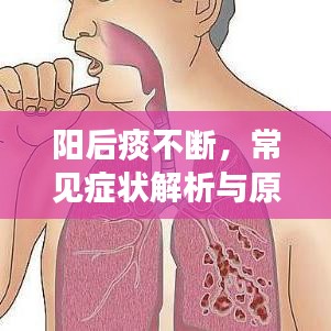 陽(yáng)后痰不斷，常見癥狀解析與原因探究