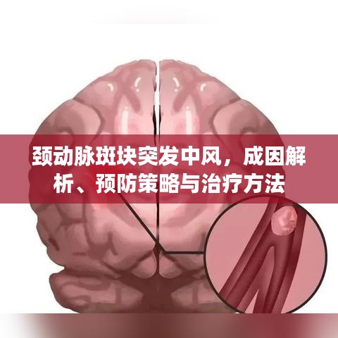頸動(dòng)脈斑塊突發(fā)中風(fēng)，成因解析、預(yù)防策略與治療方法